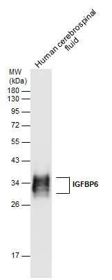 IGFBP6 antibody